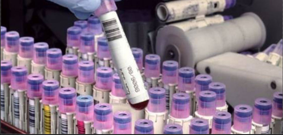 blog image blog image