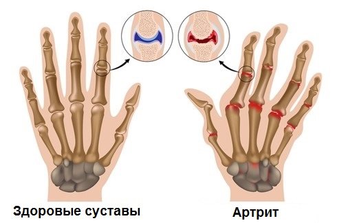 blog image blog image